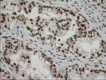 XPF Antibody in Immunohistochemistry (Paraffin) (IHC (P))