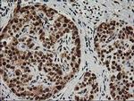 XPF Antibody in Immunohistochemistry (Paraffin) (IHC (P))