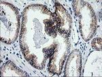 XPF Antibody in Immunohistochemistry (Paraffin) (IHC (P))