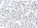 XPF Antibody in Immunohistochemistry (Paraffin) (IHC (P))