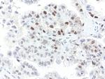 XPF Antibody in Immunohistochemistry (Paraffin) (IHC (P))