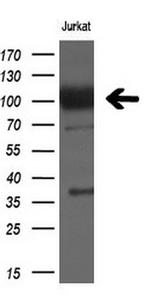 XPF Antibody in Western Blot (WB)