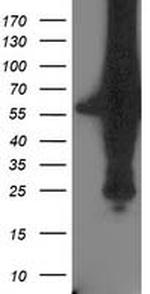 XPNPEP3 Antibody in Western Blot (WB)