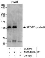 XPO6/Exportin 6 Antibody in Immunoprecipitation (IP)