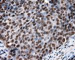 XRCC1 Antibody in Immunohistochemistry (Paraffin) (IHC (P))