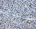 XRCC1 Antibody in Immunohistochemistry (Paraffin) (IHC (P))