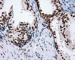 XRCC1 Antibody in Immunohistochemistry (Paraffin) (IHC (P))