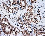 XRCC1 Antibody in Immunohistochemistry (Paraffin) (IHC (P))