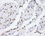 XRCC1 Antibody in Immunohistochemistry (Paraffin) (IHC (P))