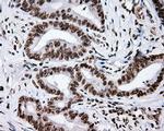 XRCC1 Antibody in Immunohistochemistry (Paraffin) (IHC (P))