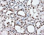 XRCC1 Antibody in Immunohistochemistry (Paraffin) (IHC (P))