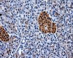 XRCC1 Antibody in Immunohistochemistry (Paraffin) (IHC (P))