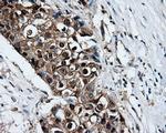 XRCC1 Antibody in Immunohistochemistry (Paraffin) (IHC (P))