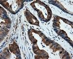 XRCC1 Antibody in Immunohistochemistry (Paraffin) (IHC (P))