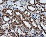 XRCC1 Antibody in Immunohistochemistry (Paraffin) (IHC (P))