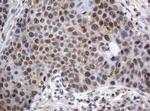 XRCC1 Antibody in Immunohistochemistry (Paraffin) (IHC (P))