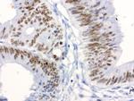 XRCC1 Antibody in Immunohistochemistry (Paraffin) (IHC (P))