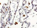 XRCC1 Antibody in Immunohistochemistry (Paraffin) (IHC (P))