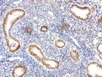 XRCC1 Antibody in Immunohistochemistry (Paraffin) (IHC (P))