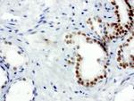 XRCC1 Antibody in Immunohistochemistry (Paraffin) (IHC (P))