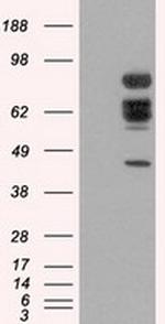 XRCC1 Antibody in Western Blot (WB)