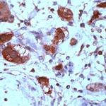 XRCC2 Antibody in Immunohistochemistry (Paraffin) (IHC (P))