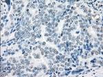 XRCC4 Antibody in Immunohistochemistry (Paraffin) (IHC (P))