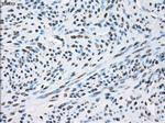 XRCC4 Antibody in Immunohistochemistry (Paraffin) (IHC (P))