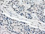 XRCC4 Antibody in Immunohistochemistry (Paraffin) (IHC (P))