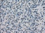 XRCC4 Antibody in Immunohistochemistry (Paraffin) (IHC (P))