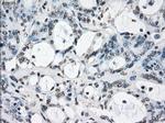 XRCC4 Antibody in Immunohistochemistry (Paraffin) (IHC (P))