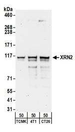 XRN2 Antibody in Western Blot (WB)