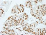 XRN2 Antibody in Immunohistochemistry (IHC)