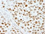 XRN2 Antibody in Immunohistochemistry (IHC)