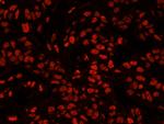 XRN2 Antibody in Immunohistochemistry (IHC)