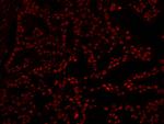 XRN2 Antibody in Immunohistochemistry (IHC)