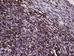 XRN2 Antibody in Immunohistochemistry (Paraffin) (IHC (P))