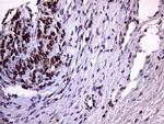 XRN2 Antibody in Immunohistochemistry (Paraffin) (IHC (P))