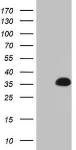 YAE1D1 Antibody in Western Blot (WB)