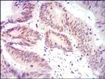 YAP1 Antibody in Immunohistochemistry (Paraffin) (IHC (P))