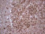 YBX1 Antibody in Immunohistochemistry (Paraffin) (IHC (P))