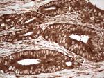 YBX1 Antibody in Immunohistochemistry (Paraffin) (IHC (P))