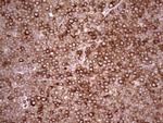 YBX1 Antibody in Immunohistochemistry (Paraffin) (IHC (P))