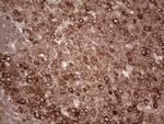 YBX1 Antibody in Immunohistochemistry (Paraffin) (IHC (P))