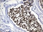 YBX2 Antibody in Immunohistochemistry (Paraffin) (IHC (P))