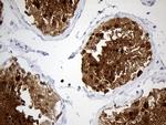 YBX2 Antibody in Immunohistochemistry (Paraffin) (IHC (P))