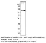 YES1 Antibody in Western Blot (WB)