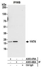 YKT6 Antibody in Western Blot (WB)