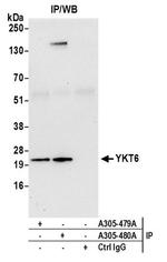 YKT6 Antibody in Western Blot (WB)