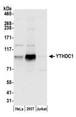 YTHDC1/YT521 Antibody in Western Blot (WB)